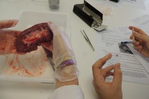 Alumnos de 1º de Bachillerato diseccionan un riñón. 