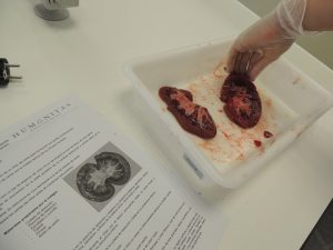 Alumnos de 1º de Bachillerato diseccionan un riñón. 